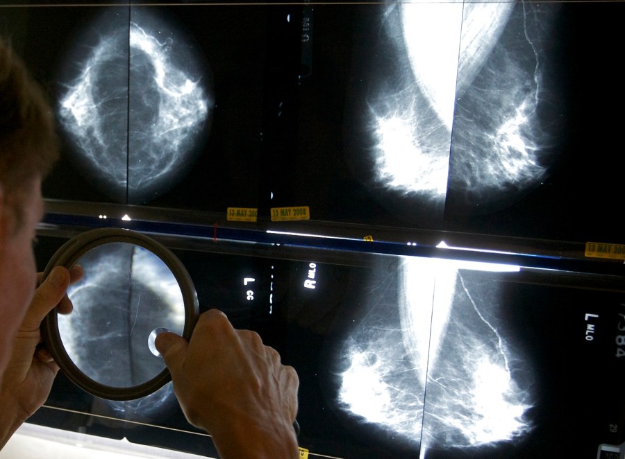 House votes to override several vetoes including mammography screening bill