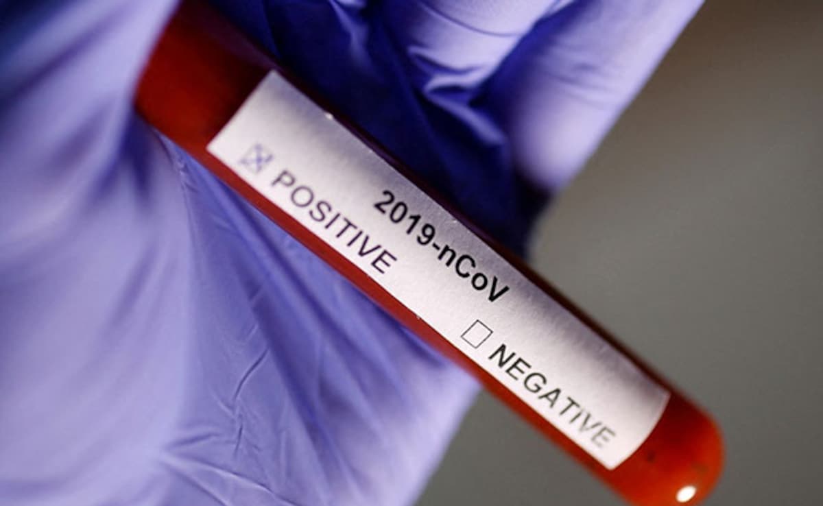 Most COVID Cases In India Mild, Under Home Care: Official Sources