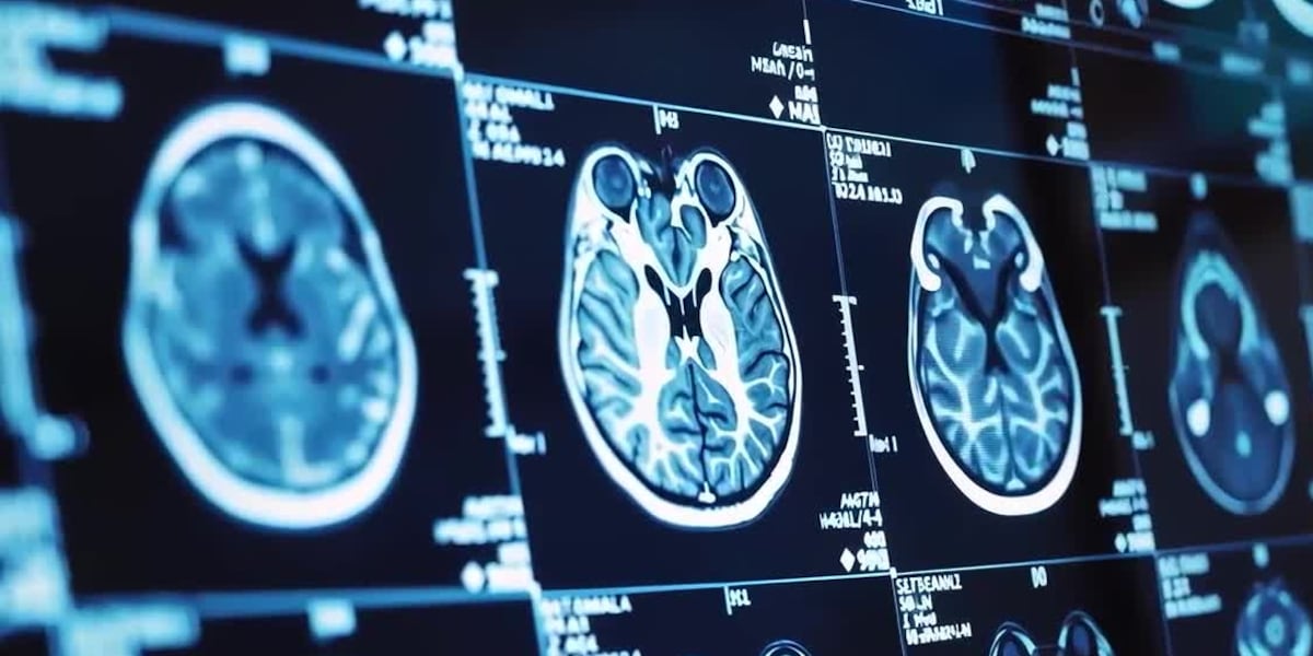 New group helps caregivers of stroke survivors