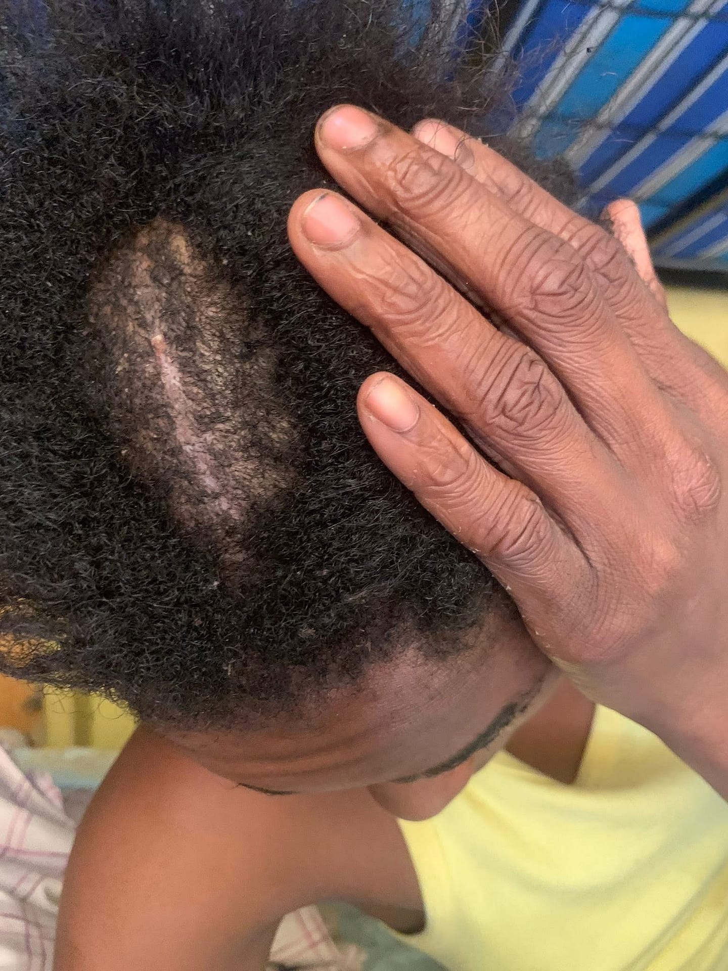 Dominican Republic Woman Finds Relief After Alleged Attacker Held in Antigua