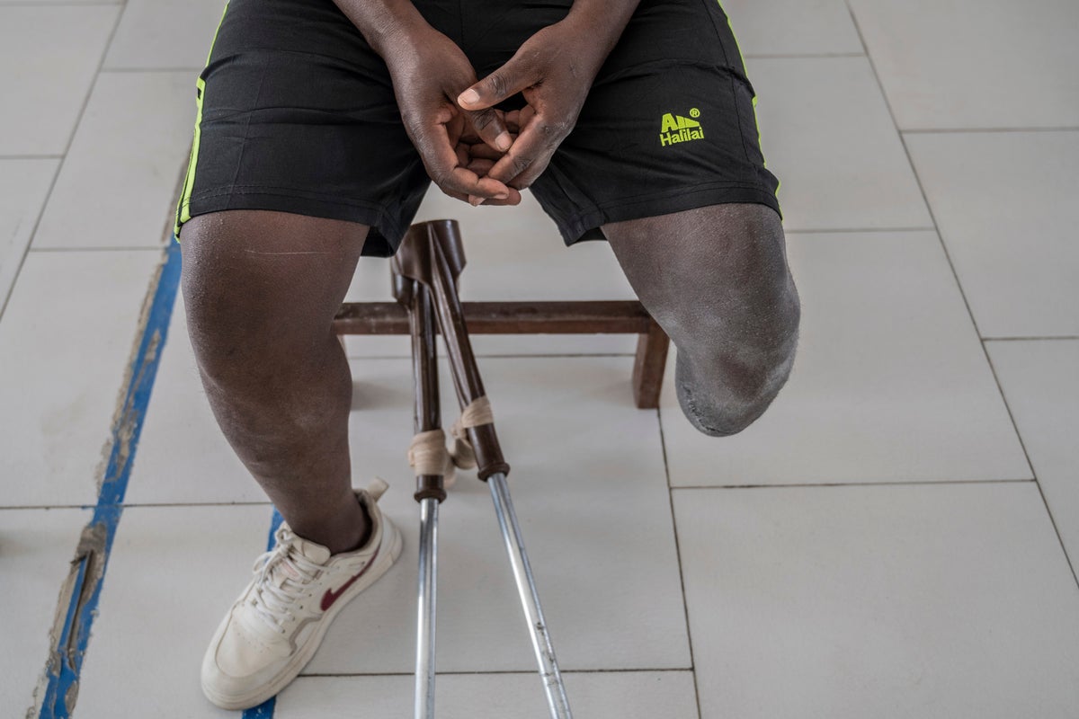 On the front line of Congo’s conflict, a trauma center tells a story of horror and survival