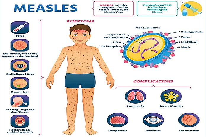 PAHO intensifies call to strengthen vaccination in light of rising measles cases in the Americas