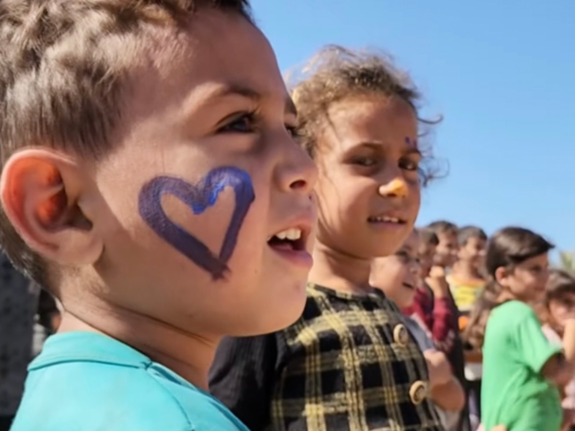 Acute trauma: The ever-present wounds of Gaza’s children from Israel’s war | Gaza News