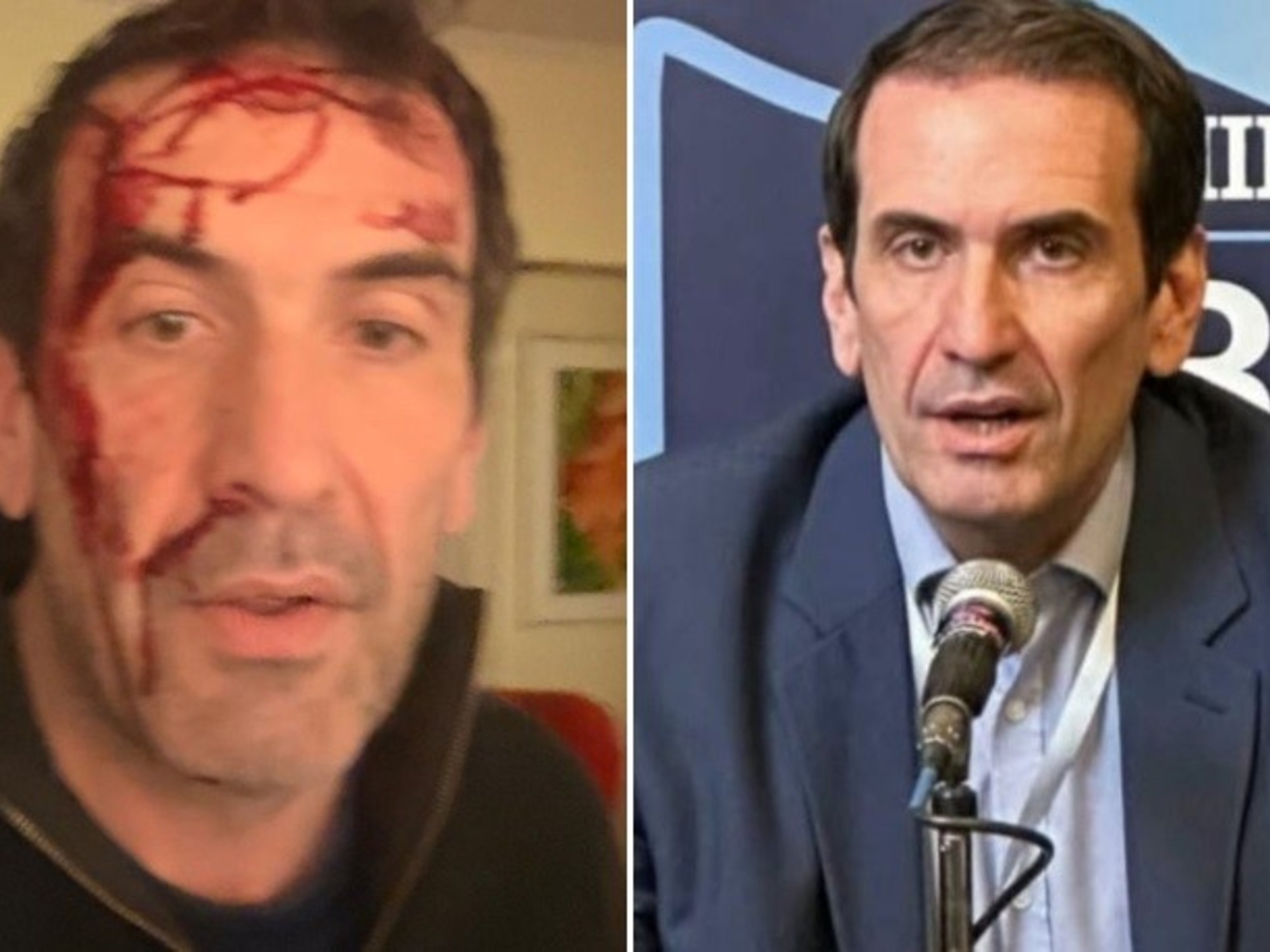 Asaltaron y golpearon a Pablo Cervi, candidato libertario en Neuquén, a horas de las elecciones