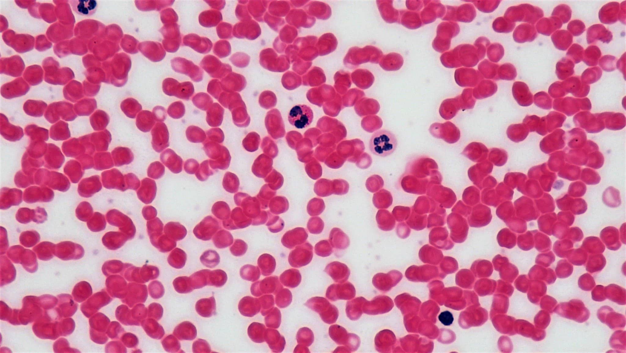 human blood cells laboratory