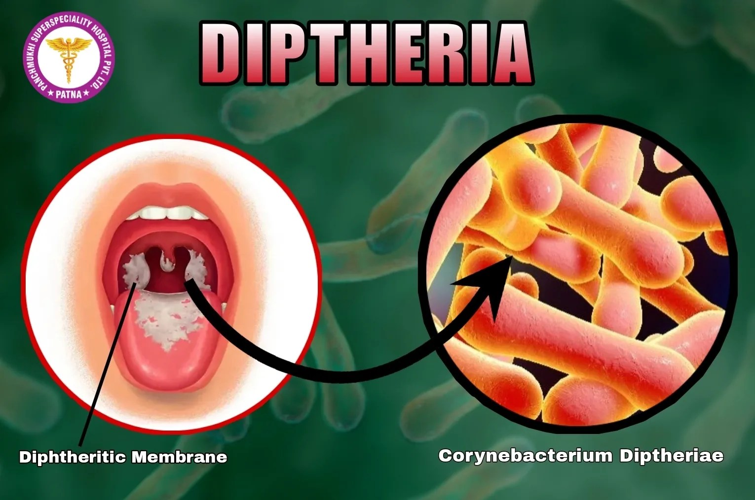 Cudur halis ah oo Soomaaliya loogu dhimanayo - 87 geeri iyo 1,600 kiis oo la shaaciyey