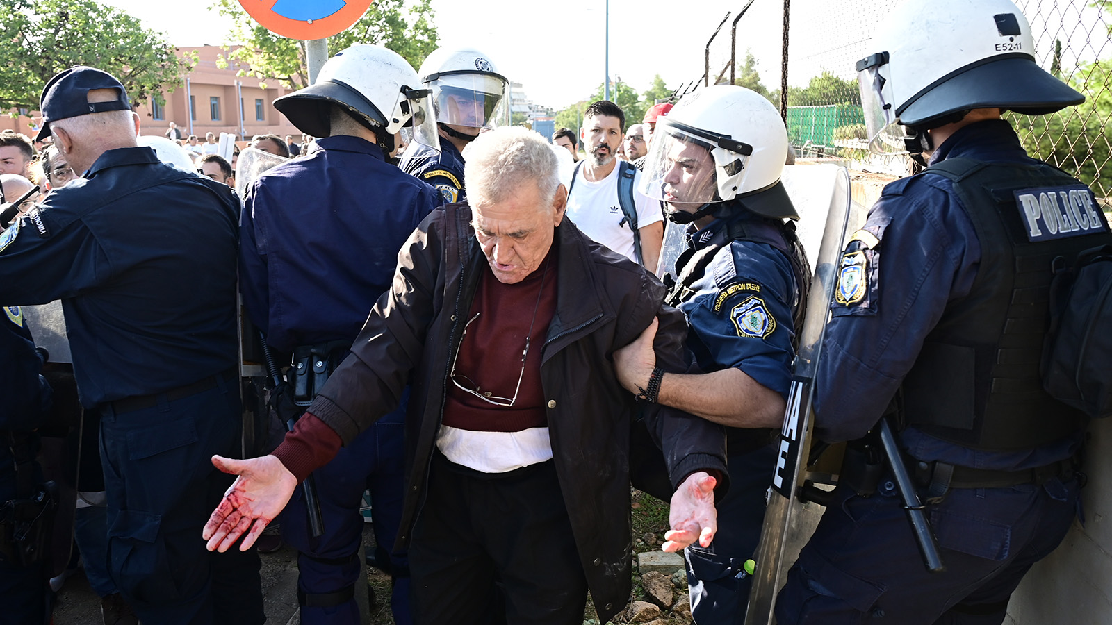 Tear gas and batons against protesting hospital workers during Mitsotakis' visit
