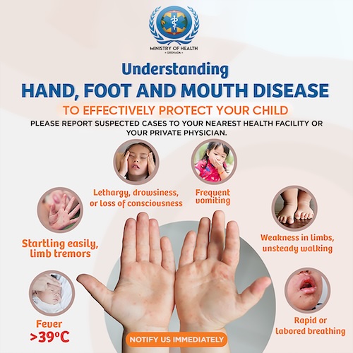 Hand, Foot, and Mouth Disease outbreak