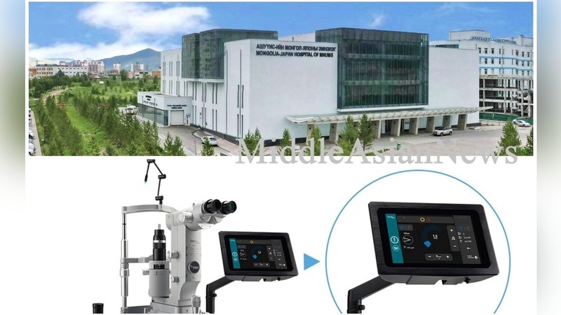 Mongolia Japan Hospital introduces selective laser trabeculoplasty system