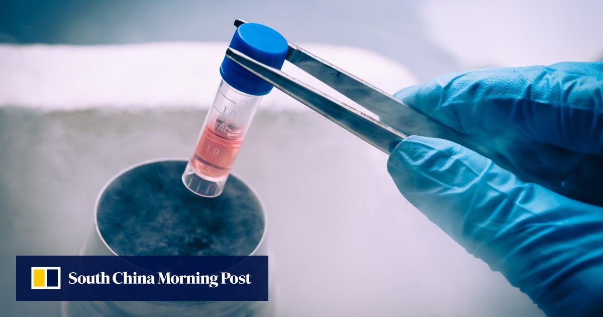 Chinese scientists develop promising stem cell therapy for Parkinson’s disease