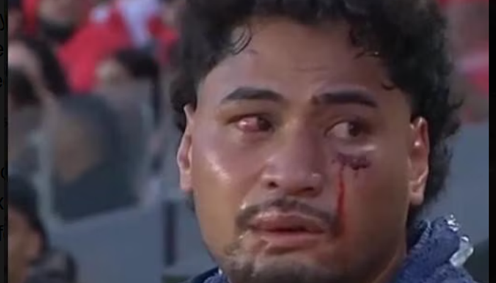 NRL proposes two-year ban for medics over concussion breaches in Eliesa Katoa case