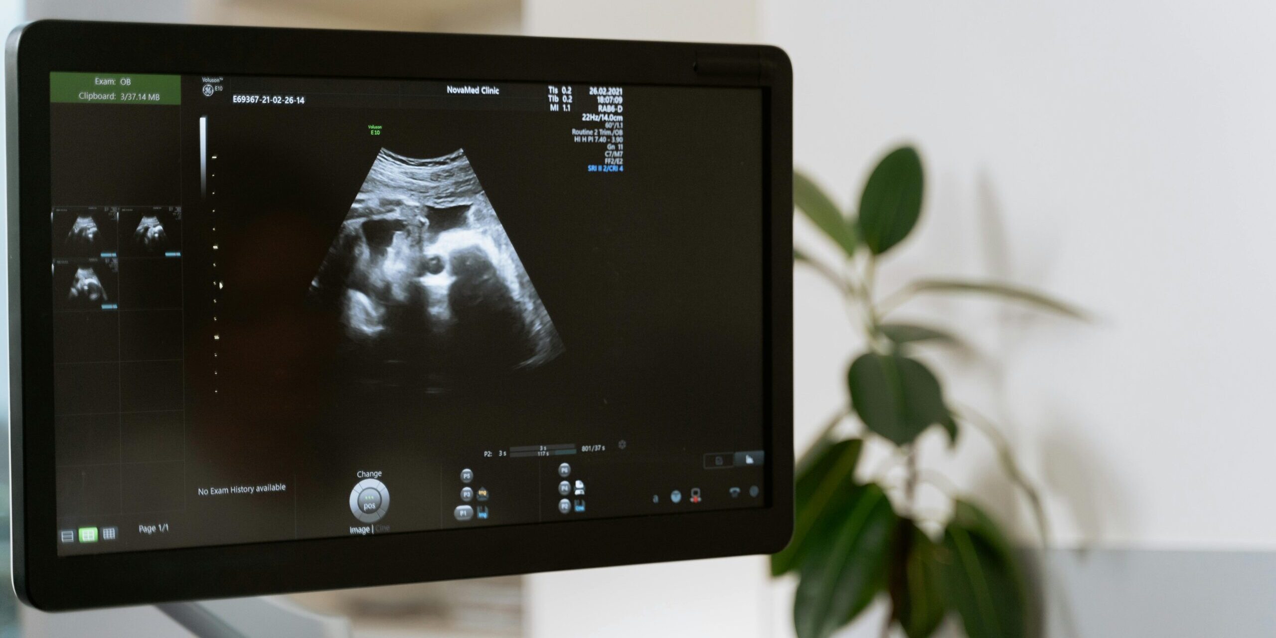 Prosecutors drop case against Polish doctor who performed abortion in ninth month of pregnancy