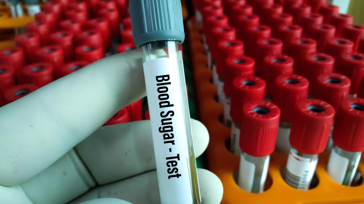 Anaemia, blood disorders can distort diabetes test HbA1c results, says study