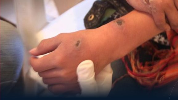 Field visit to Sabratha to discuss combating leishmaniasis and the safe disposal of medical waste