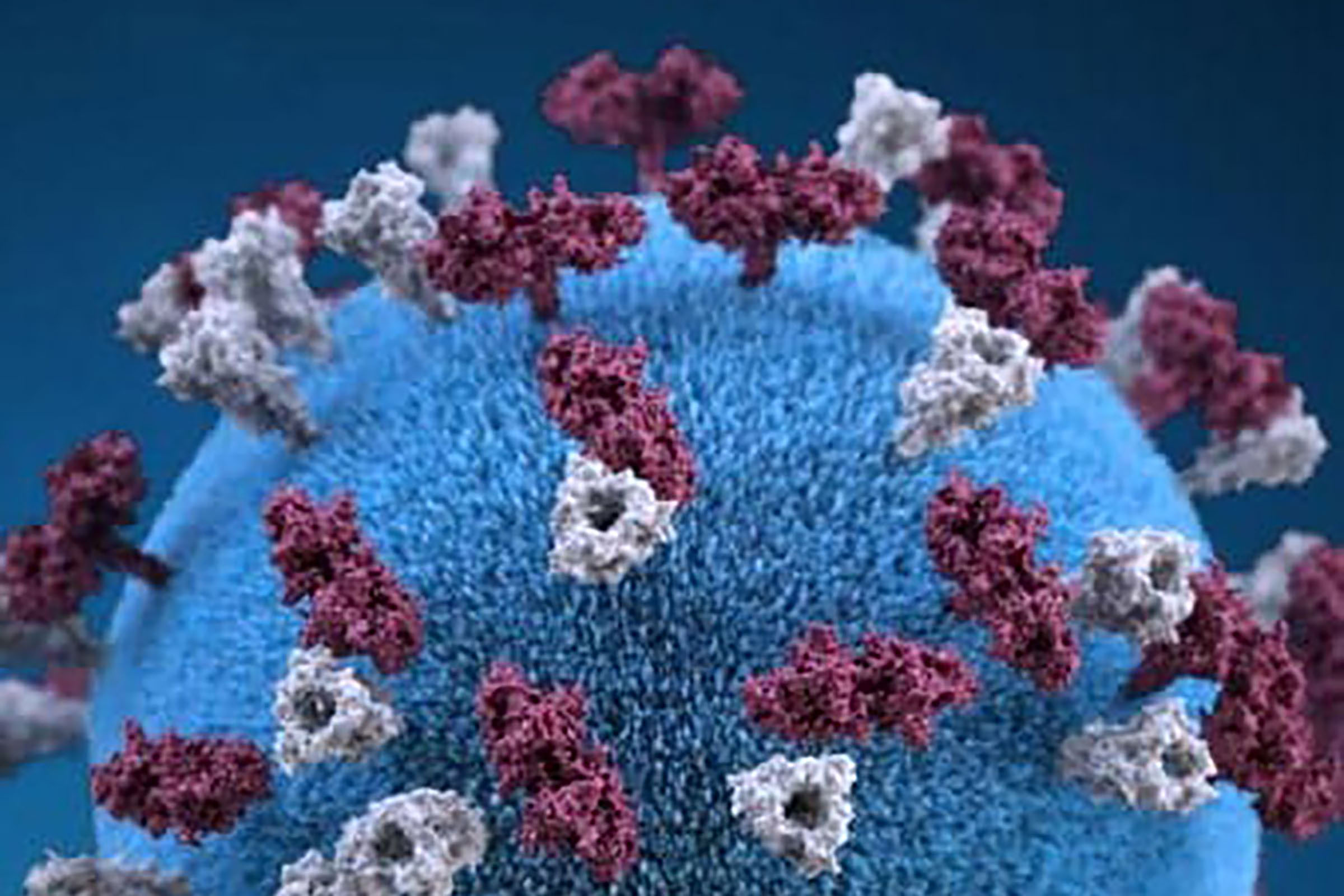 Measles alert issued in Vermont's Washington County