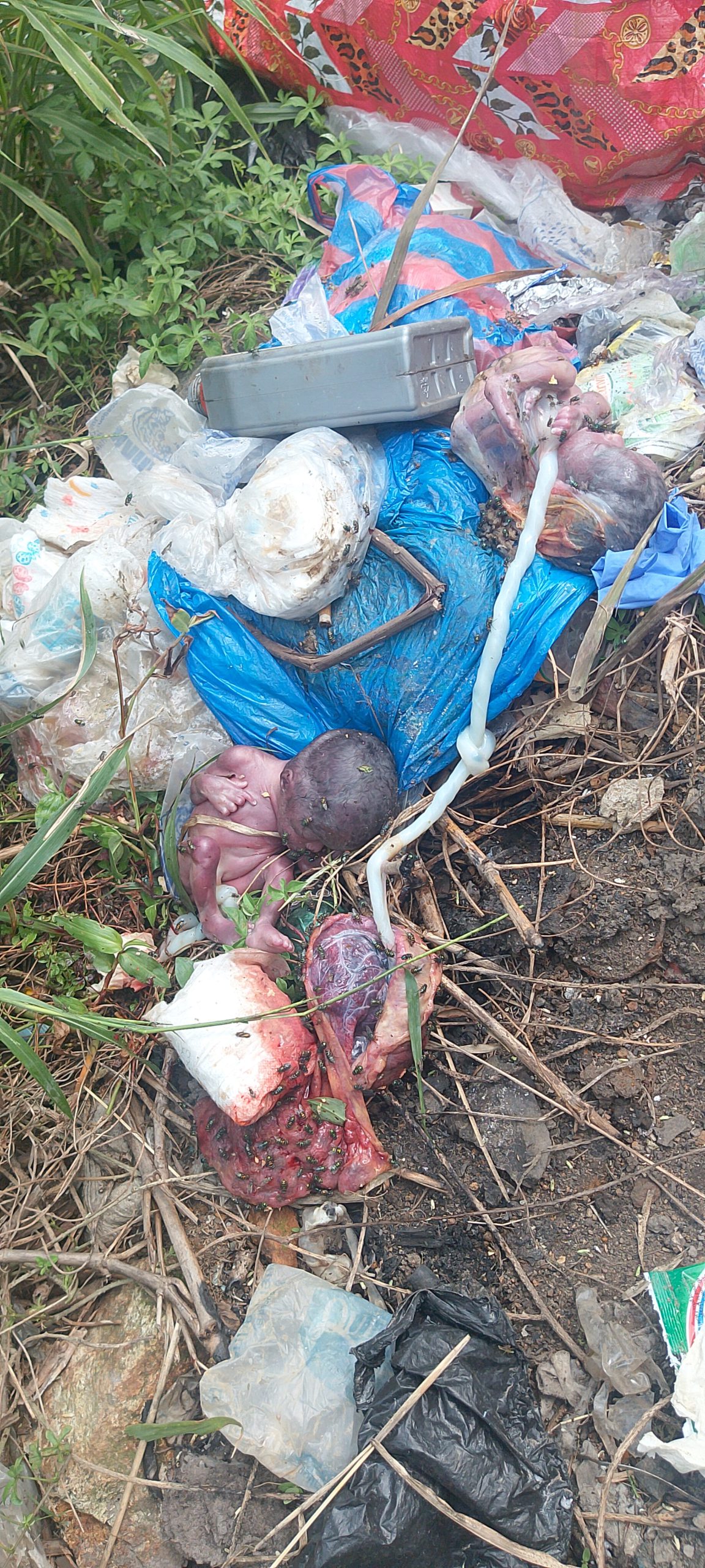 Aborted Twins Found Dead at Logan Town Dump-Site