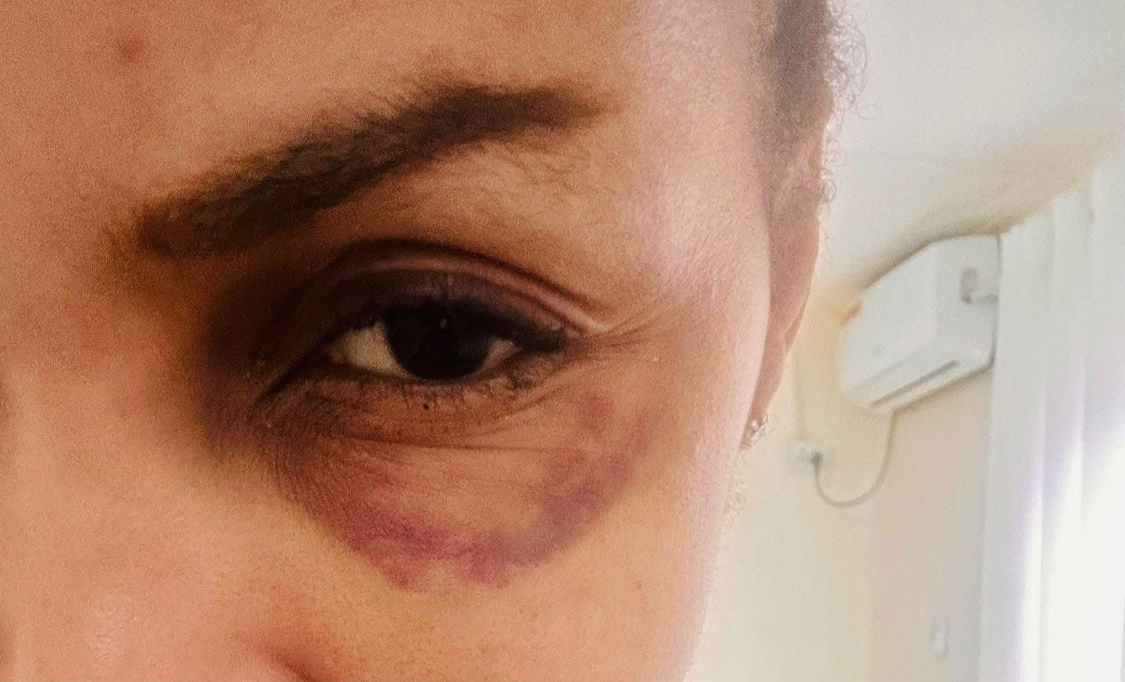 Editorial: When Silence Shields Abuse, Victims Suffer Alone