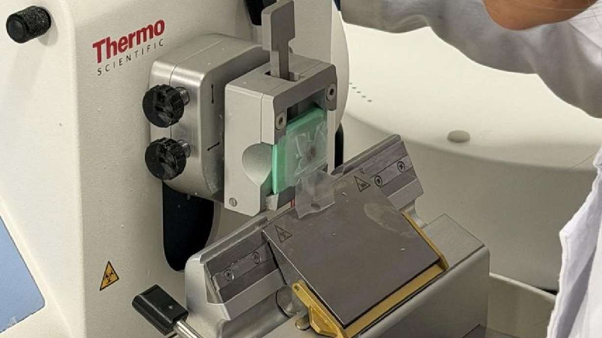 Spanish researchers develop low-cost artificial cornea from fish scales