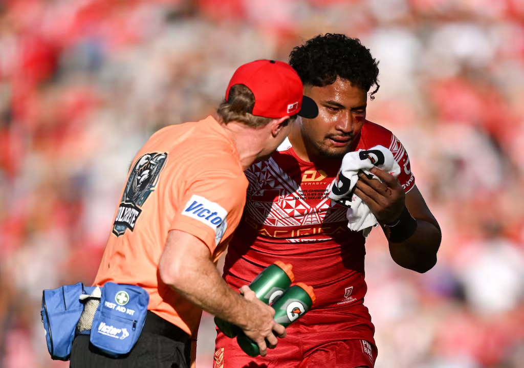 Tonga star may never play again after brain injury - Storm coach