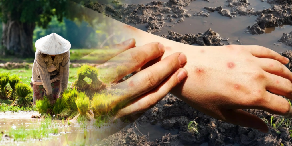 Thailand Reports Melioidosis Cases in Northeast Regions near Laos