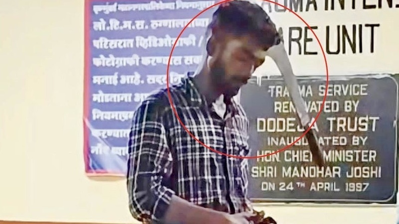 Mumbai man walks into hospital with machete stuck in head, doctors save him