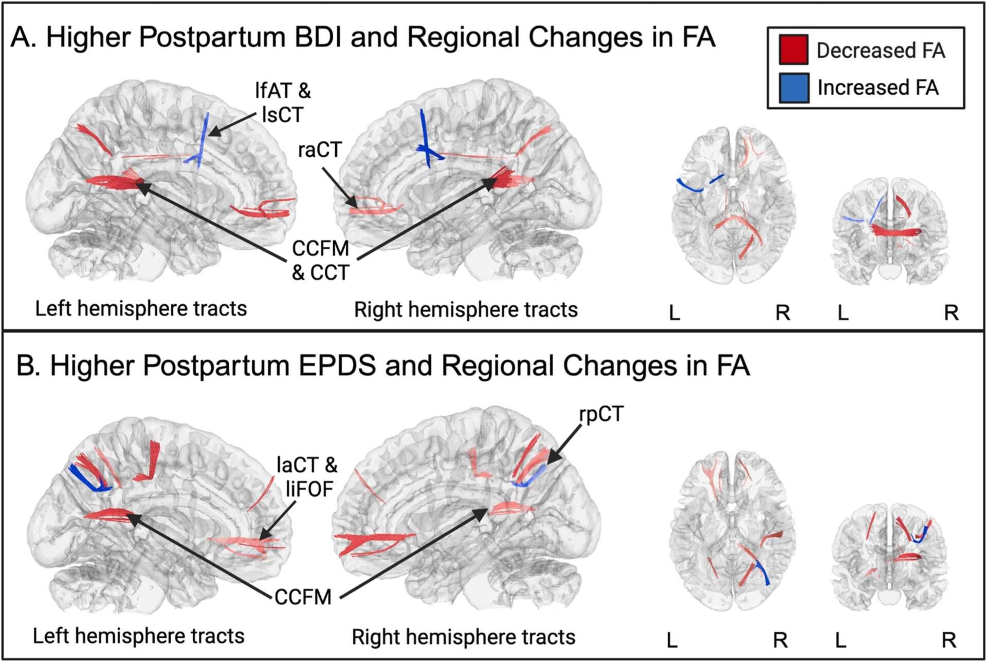 Darby Saxbe / "White matter microstructure organization across the transition to fatherhood"