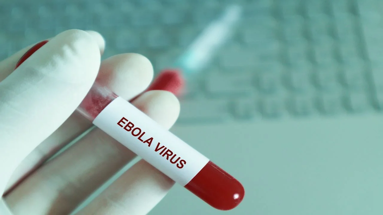 Uganda confirms Ebola outbreak after Kibuli hospital death