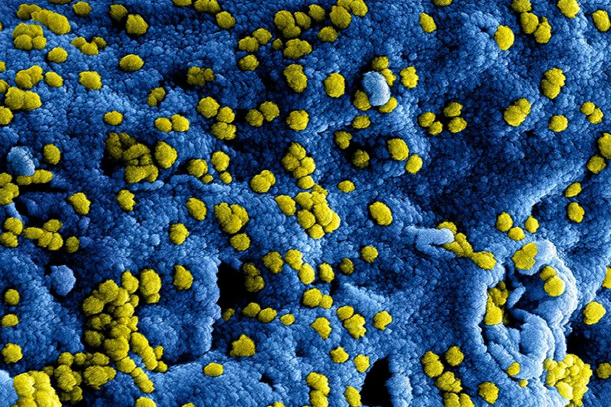 WHO declares global health emergency over Ebola outbreak in Congo, Uganda