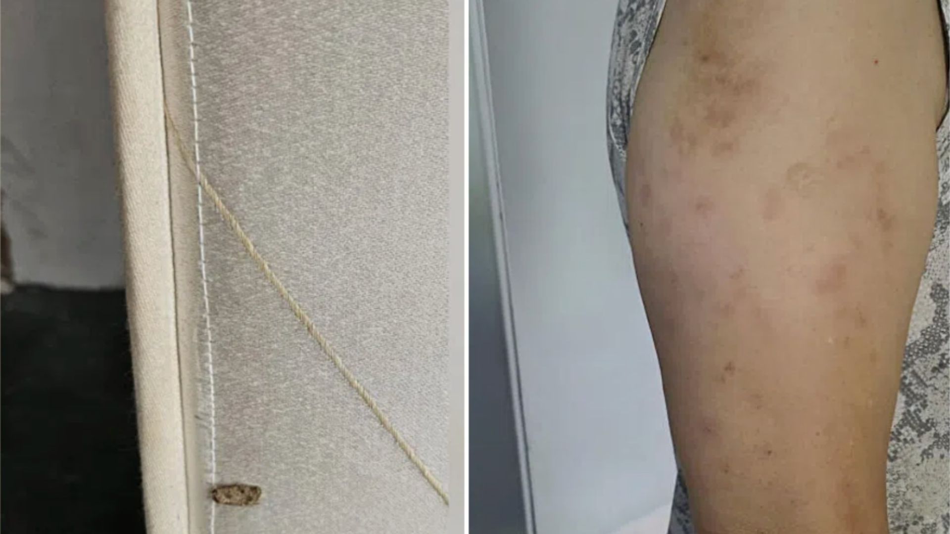 'We originally thought there were mosquitoes': Hougang residents blame discarded mattress for infestation of bedbugs