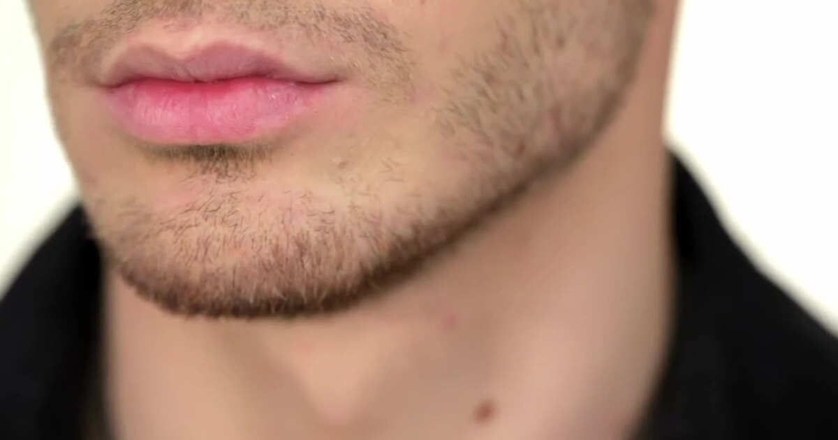 What is 'Looksmaxxing' and why are doctors sounding the alarm?
