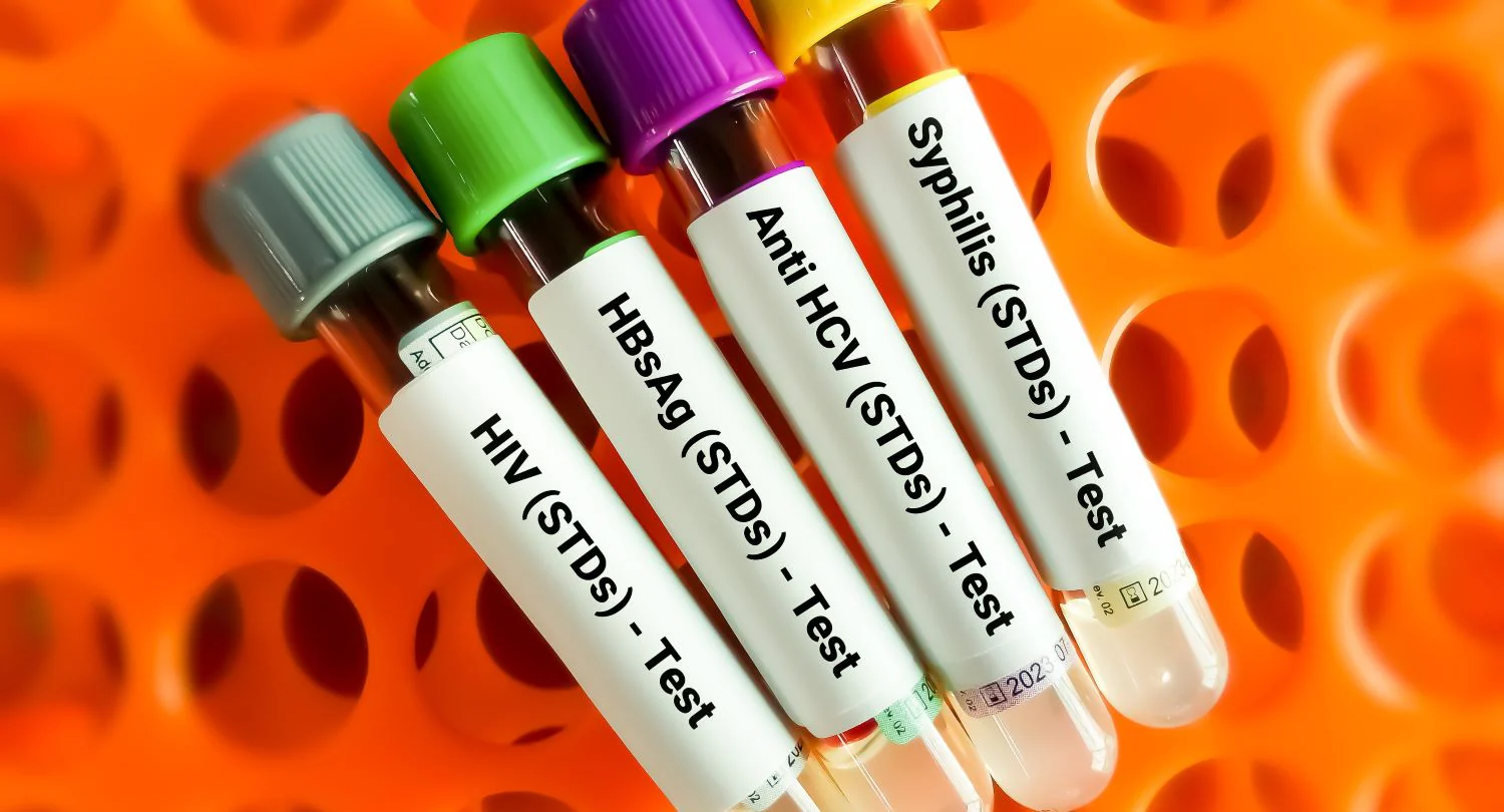 Blantyre records decline in STI cases