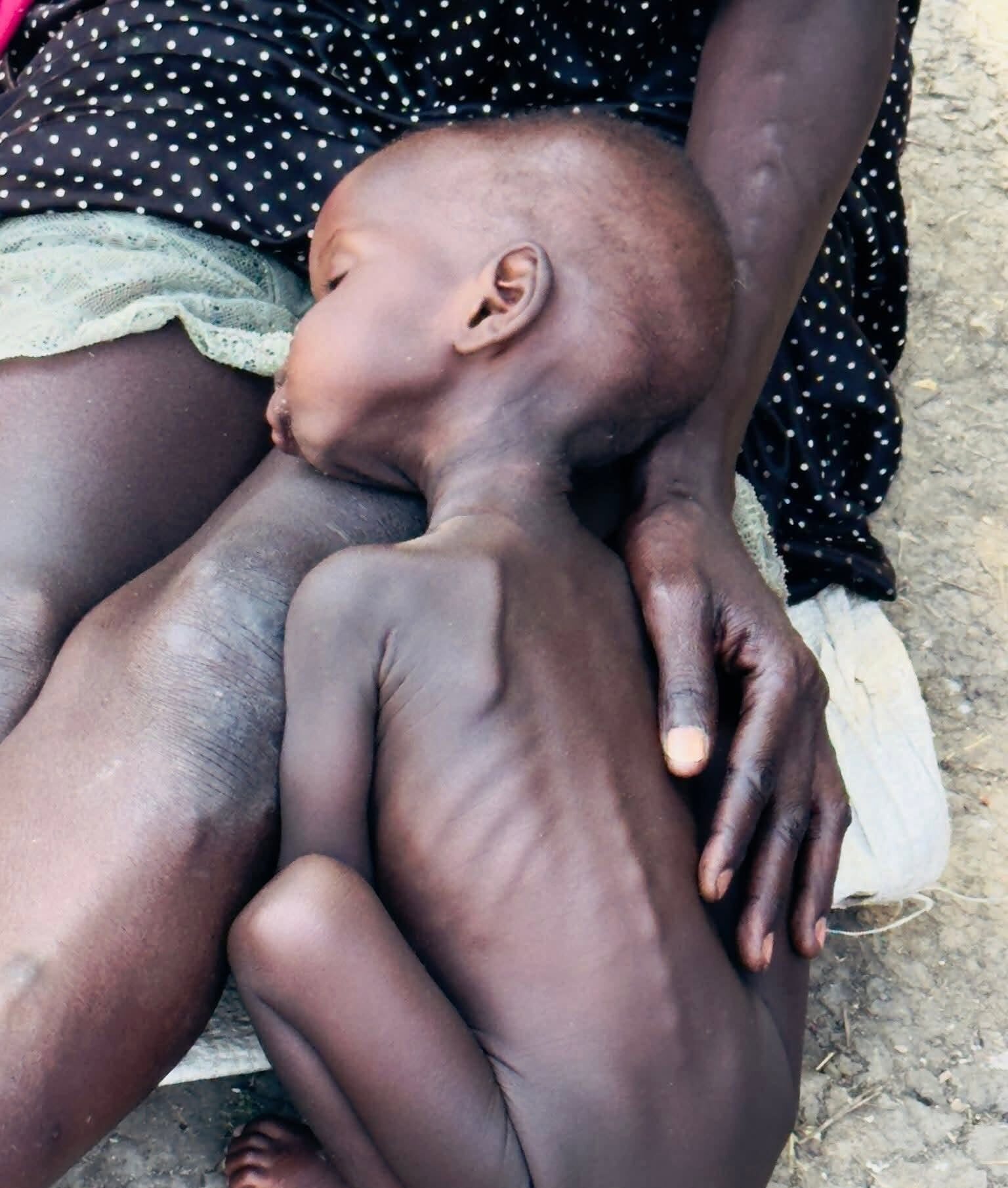 Children survive on leaves, water lilies as hunger deepens in Jonglei - Save the Children
