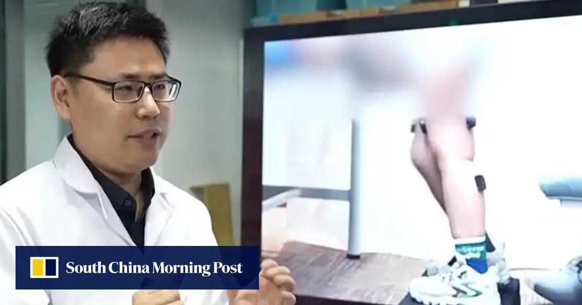Chinese robot helps children with nerve disorder stand up for the first time