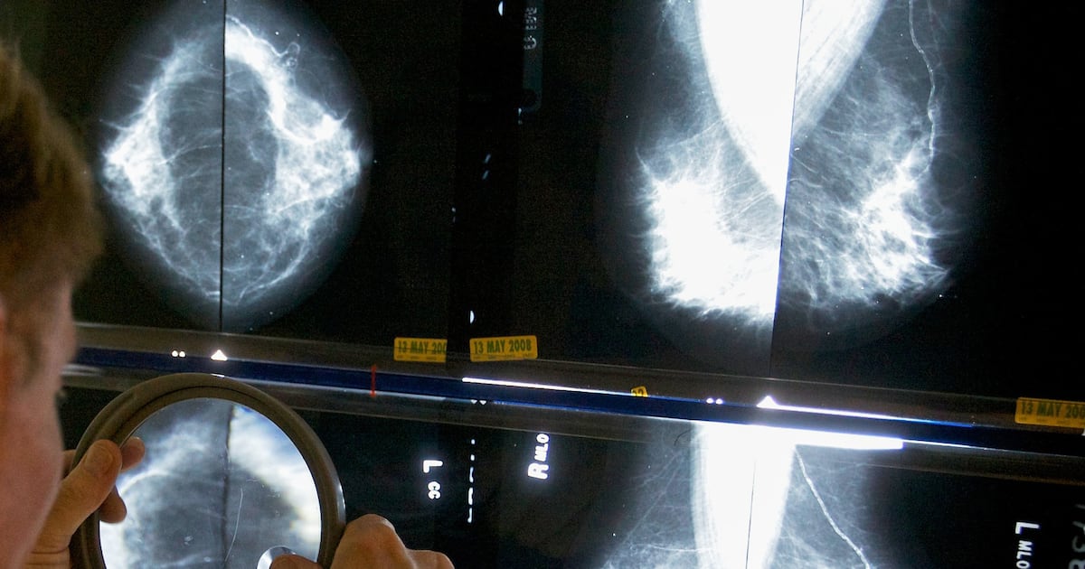 Cancer cases worldwide are expected to soar in the coming decades, a report finds. Here’s why.