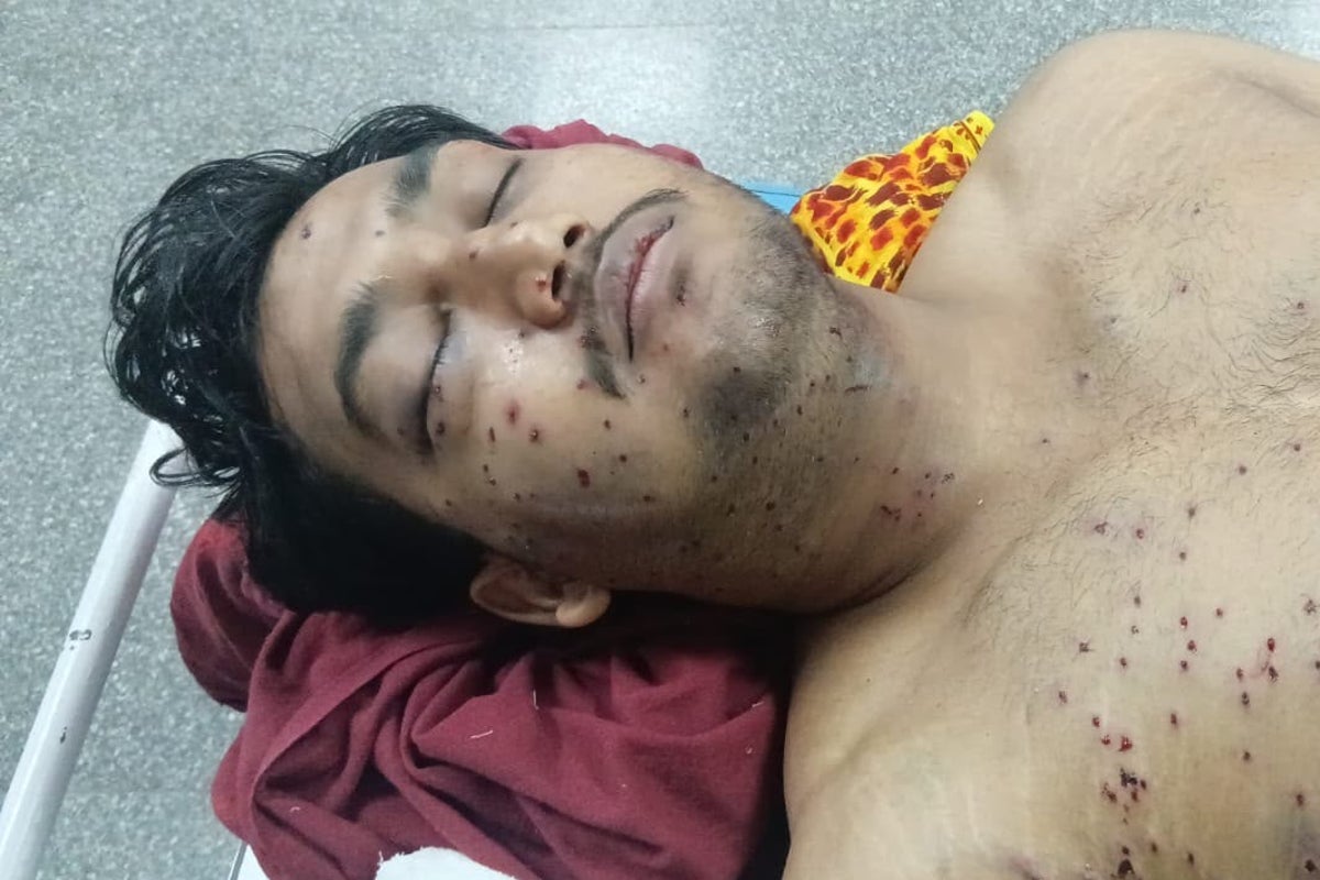 Indian authorities admit controversial ‘pellet gun’ used on protesters but blame rogue officer