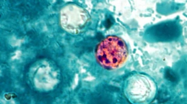 Lettuce not included in Taylor Farms recall tests positive for Cyclospora - Indianapolis News | Indiana Weather | Indiana Traffic