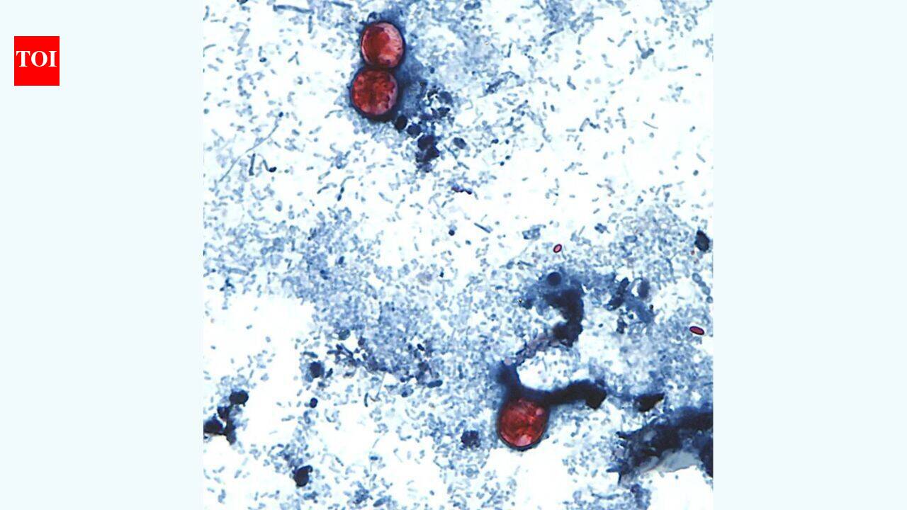 Michigan Records Largest Cyclospora Outbreak with Nearly 1,000 Cases | World News