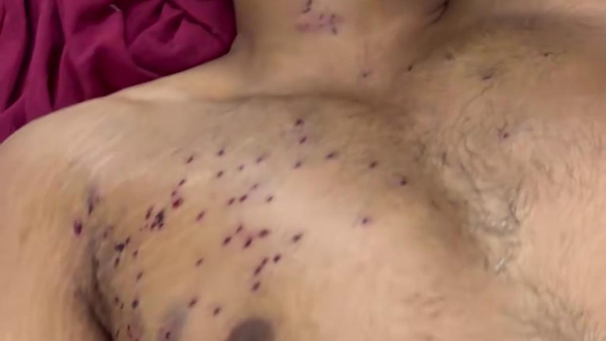 Pellet guns, shock batons used against protesters in Delhi; police deny