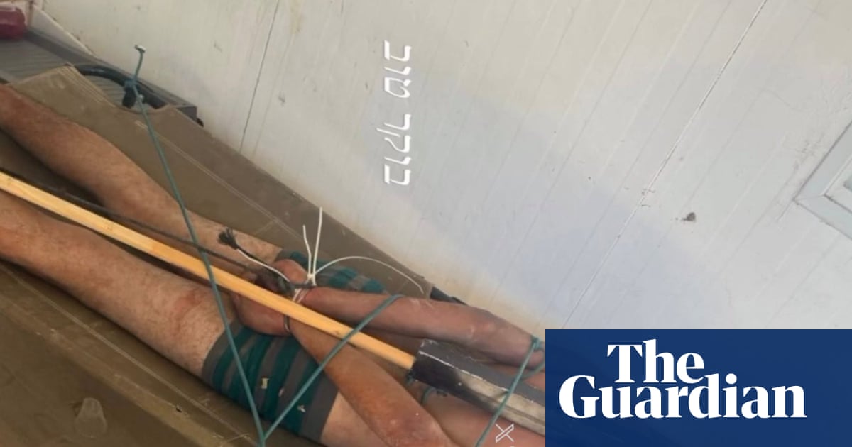 Photo of bound Palestinian detainee corroborates Israeli torture reports, say rights groups | Israel