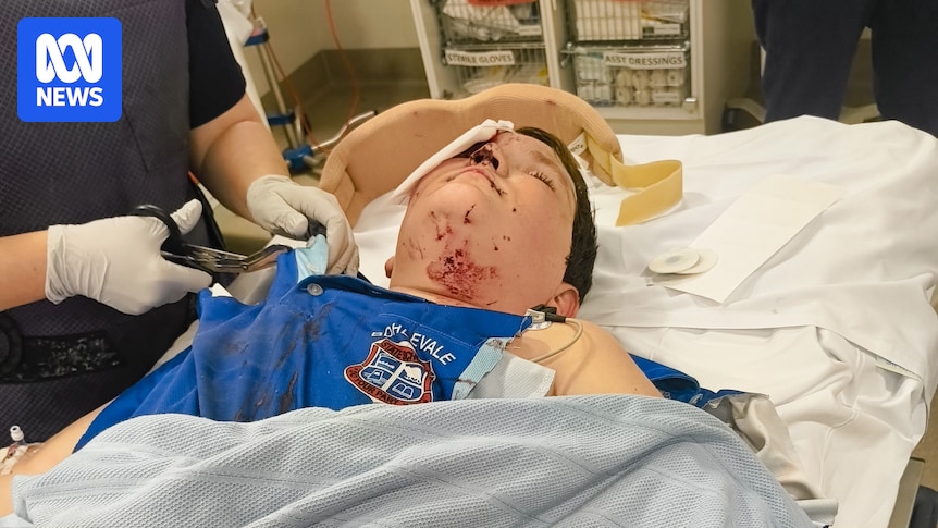 Townsville boy left with broken eye socket from e-scooter collision