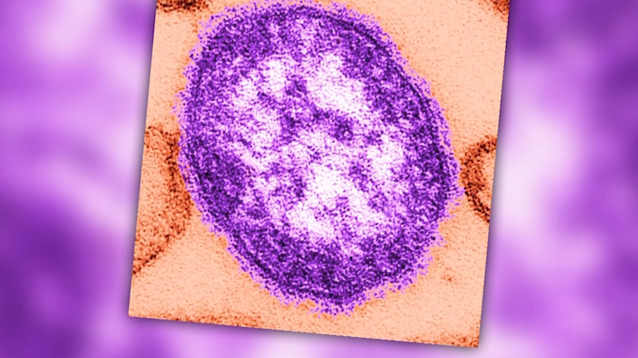 UPDATE: Delaware Declares Measles Outbreak