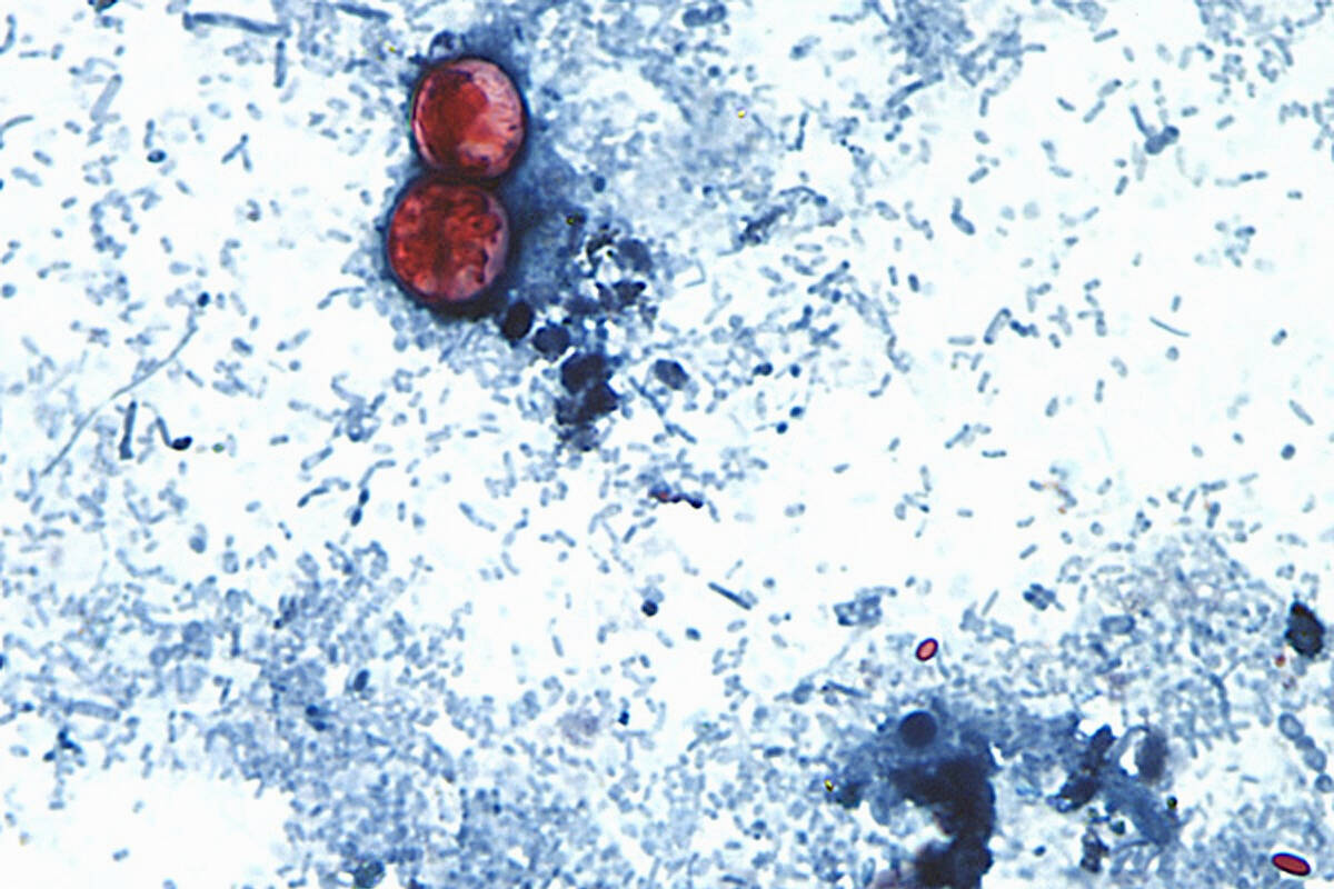 FILE - This undated photo taken through a microscope provided by the CDC shows Cyclospora cayet ...