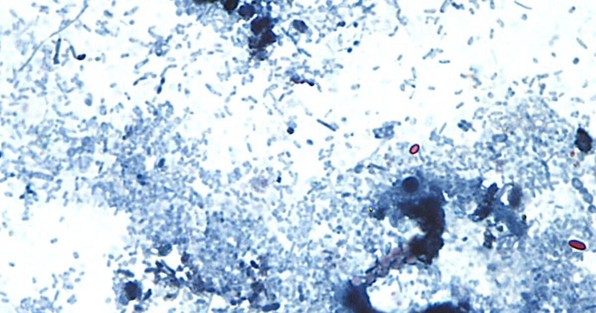 First people in the US die from diarrhea parasite outbreak | News