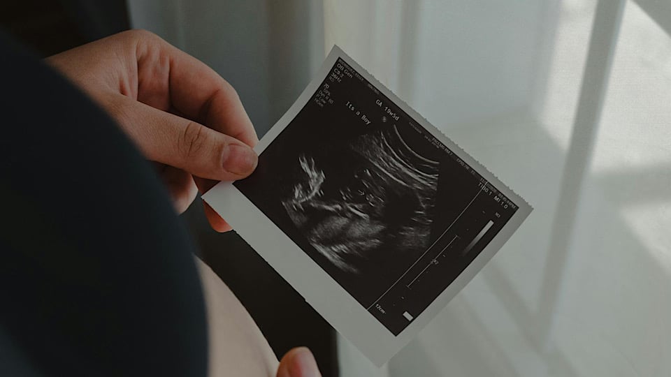 Increasing numbers seeking post-abortion counselling
