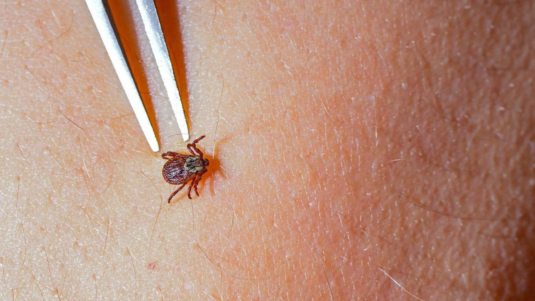 Lyme Disease Cases Surge in Czechia With 90 New Cases a Day