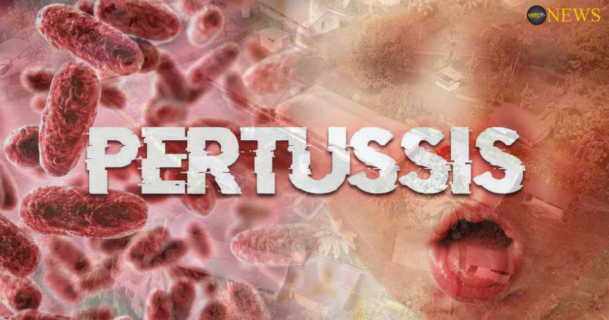 Pertussis Outbreak Declared on Ambae- MOH
