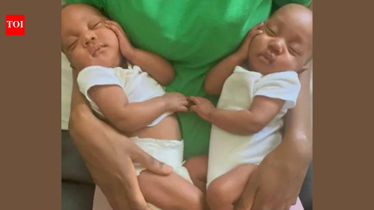 Rare twin girls were born hugging inside the same amniotic sac; after nearly two months in intensive care, they finally went home together