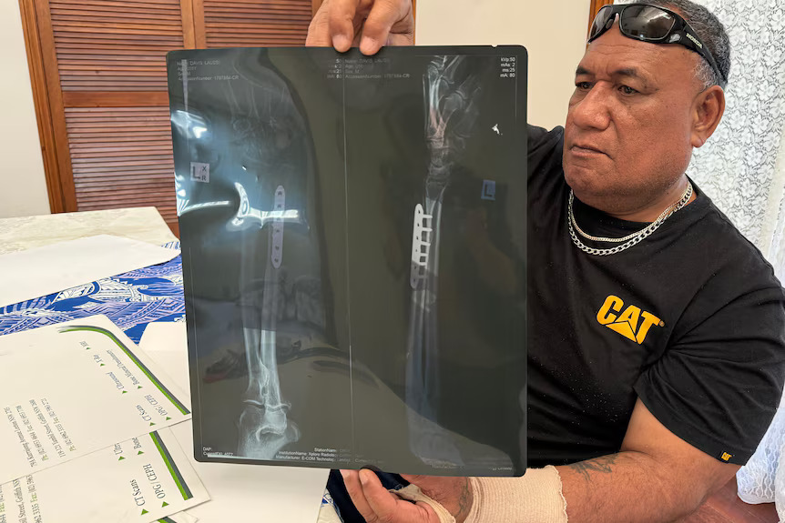 Tongan PALM worker’s injury exposes gaps in Australia’s labour scheme