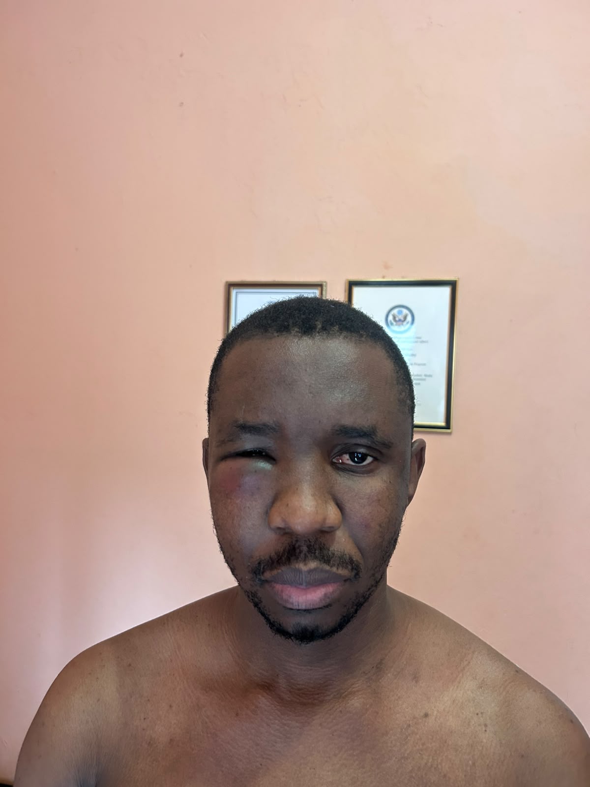 Boloetse abduction sends chilling warning to Lesotho’s media