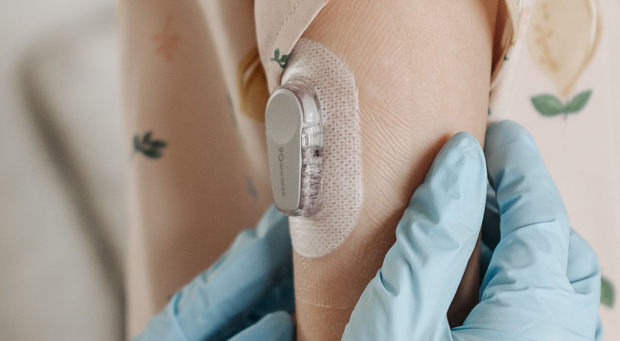 Jarbandhan: "SZF stopt dekking kosten glucosesensoren voor kinderen met suikerziekte type 1"